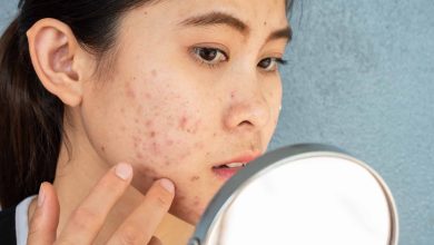 Acne Treatment Clinic Singapore: Which Tablet do they Recommend for Face Pimples?
