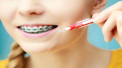 Coordinating Dental Cleanings With Active Orthodontic Treatment: A Family Guide