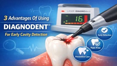 3 Advantages Of Using Diagnodent® For Early Cavity Detection
