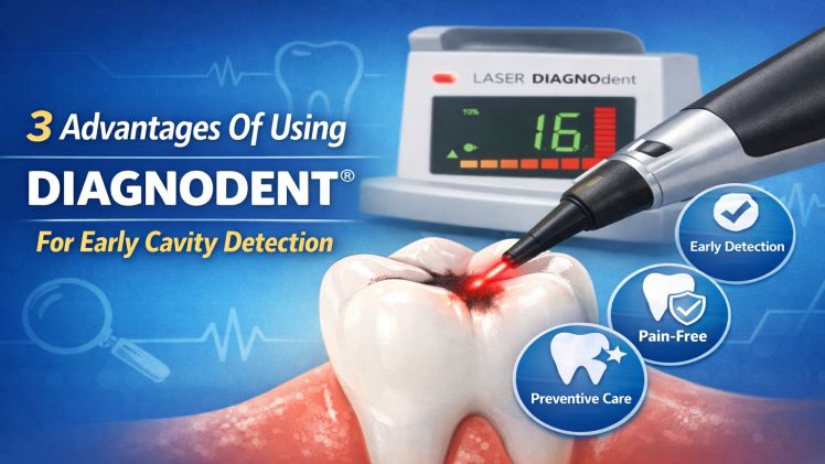 3 Advantages Of Using Diagnodent® For Early Cavity Detection